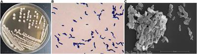 Isolation and Characterization of a Novel Diethylstilbestrol-Degrading Bacillus subtilis JF and Biochemical Degradation Metabolite Analysis